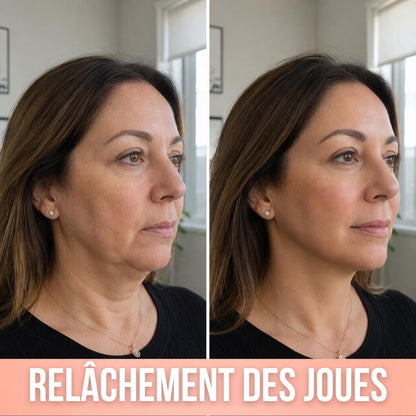 Khleopatra — Dispositif de Compression à Libération de Collagène 300 Daltons
