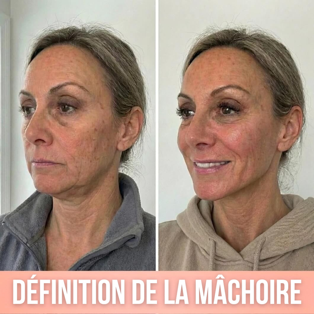 Khleopatra — Dispositif de Compression à Libération de Collagène 300 Daltons