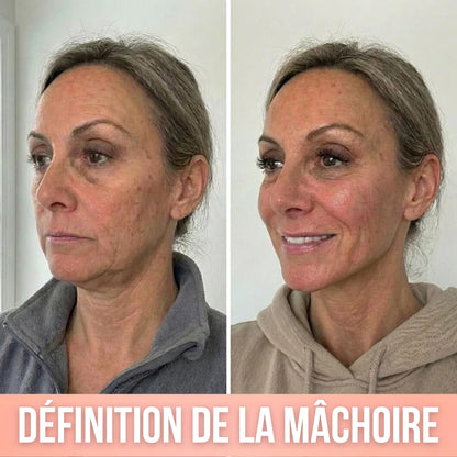 Khleopatra — Dispositif de Compression à Libération de Collagène 300 Daltons