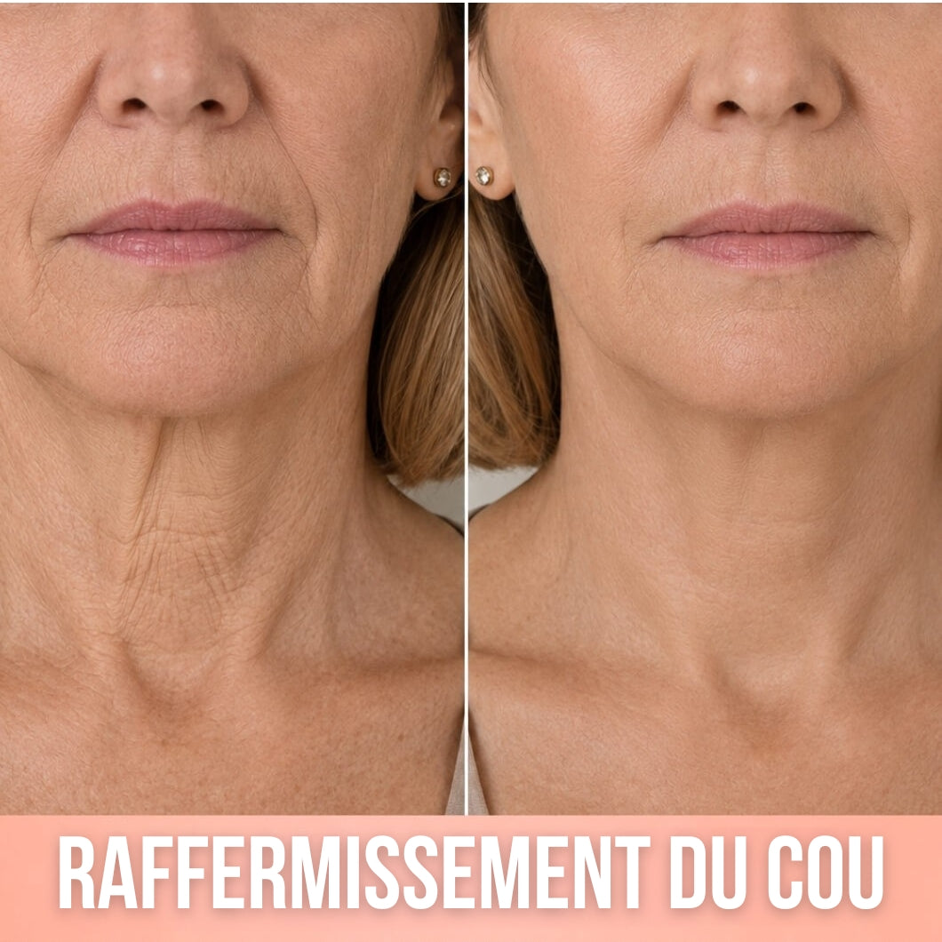 Khleopatra — Dispositif de Compression à Libération de Collagène 300 Daltons