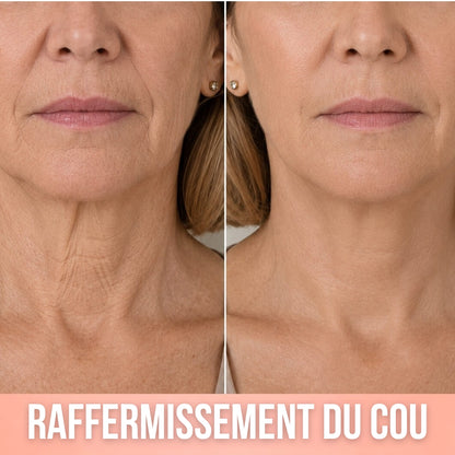 Khleopatra — Dispositif de Compression à Libération de Collagène 300 Daltons
